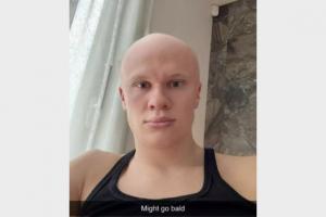 太凶相了😱哈兰德晒自己P光头照，网友：外星人👽️