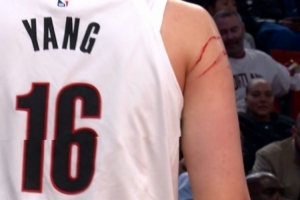开拓者媒体人：杨瀚森被抓出血印实属正常  约基奇每晚都这样