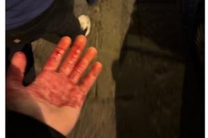 看球小心！切尔西球迷被那不勒斯球迷捅伤，蓝军官方提醒注意安全